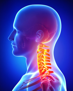 x-ray illustration of neck pain