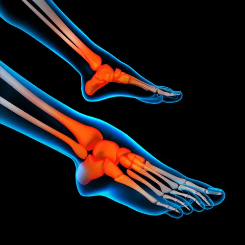 graphic showing foot and ankle pain