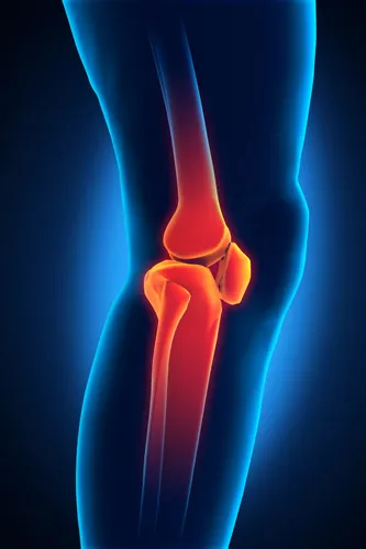 graphic of knee pain